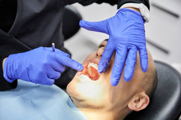 Best Emergency Dentist for Lost Fillings or Crowns in Springfield, KY